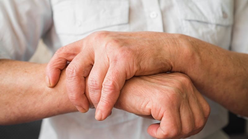 يد مريضة تعاني من التهاب المفاصل الروماتيزمي